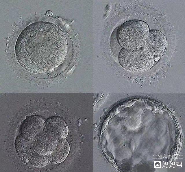 辽宁私立供卵试管婴儿医院供卵试管婴儿前男女检查项目多，过期不候