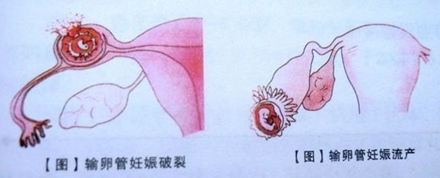 做一次做供卵二代自怀试管需要多少钱做供卵自怀医院的费用］