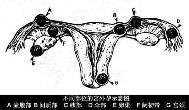 做一次做供卵二代自怀试管需要多少钱做供卵自怀医院的费用］
