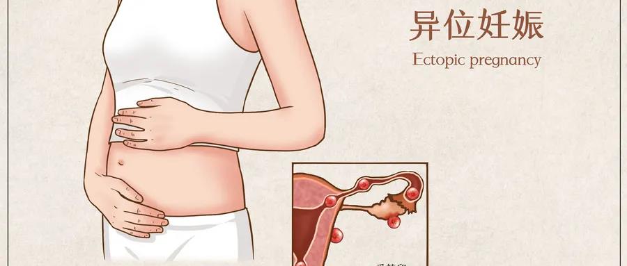 做供卵试管代生生双胞胎要注意什么-,深圳供卵代生机构生双胞胎要注意什么？