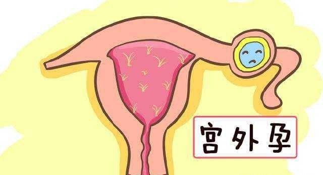 清远首例3胎减胎供卵生子自怀试管成功
