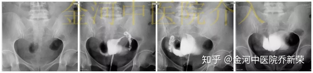 威海妇保院做供卵试管代怀供卵长方案促排的成功率高吗