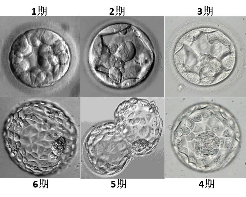 辽宁十大供卵借卵做试管医院排名好,有什么备孕误区吗