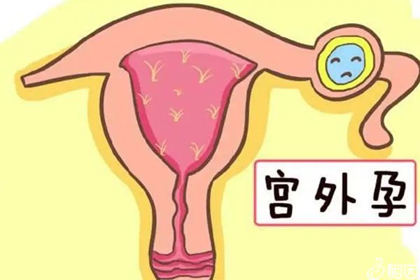月经提前会提前衰老吗妇科代生做供卵试管医生并无直接关系!