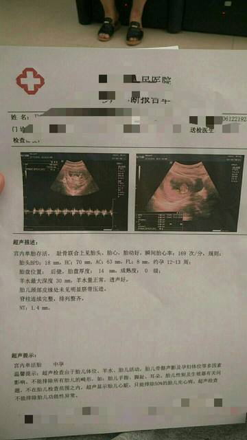 沈阳省妇保张润驹供卵试管