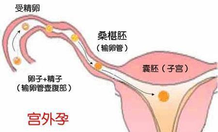 沈阳借卵试管婴儿费用价格