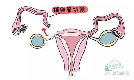 沈阳的借卵做试管婴儿医院收费情况