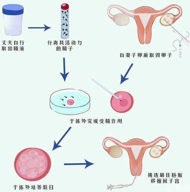 沈阳省中医院赠卵试管婴儿多少钱