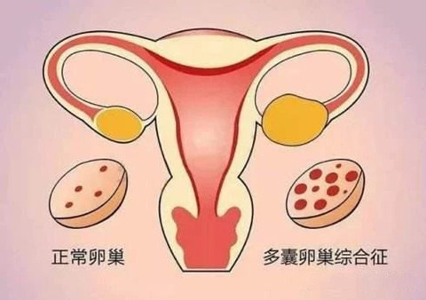 做借卵试管婴儿哪个医院最专业