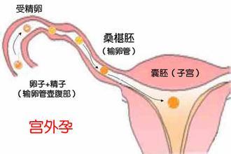 做供卵试管沈阳最好吗