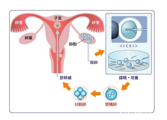 供卵试管婴儿为什么放两个