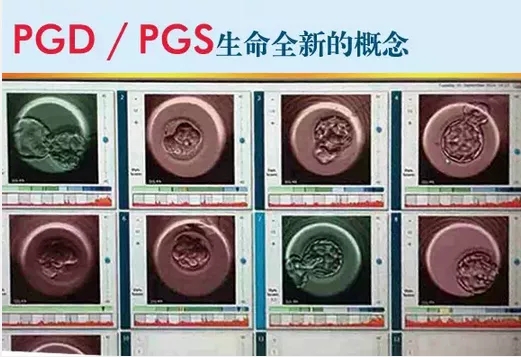 试管婴儿促排期间感冒了怎么办