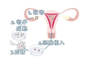卵巢早衰113能自然怀孕吗
