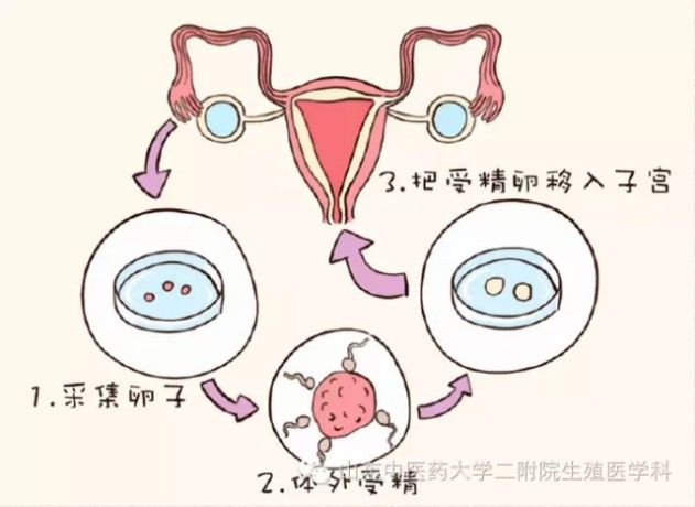 卵巢早衰113能自然怀孕吗