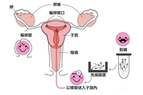 第三代试管婴儿可以移植两个胚胎吗