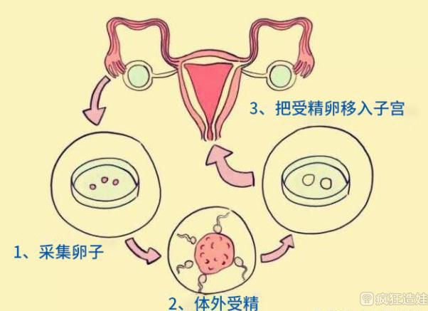 沈阳妇幼试管婴儿费用大概要多少钱
