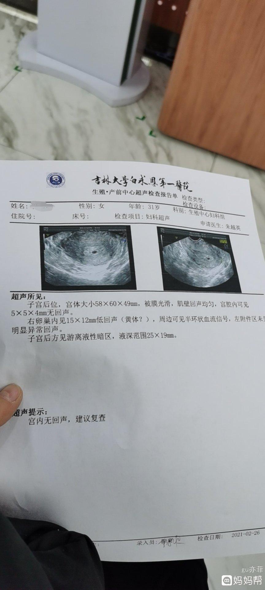 试管囊胚预产期计算器