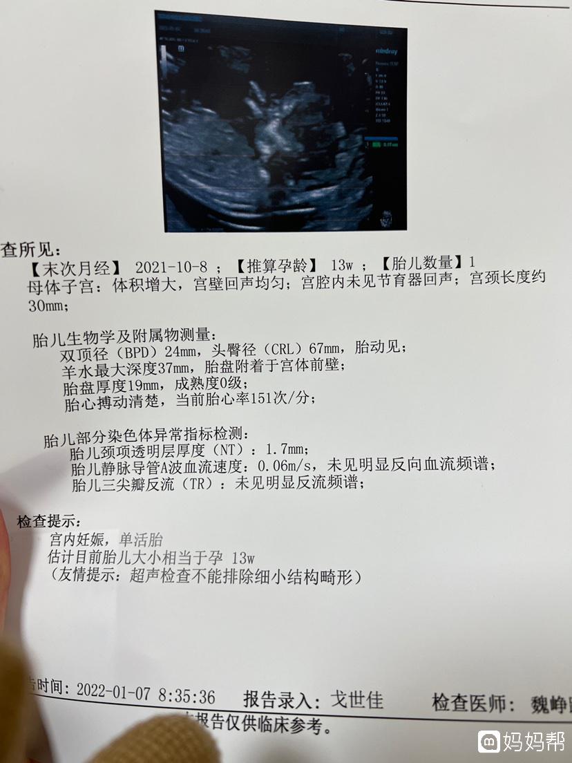 女人卵巢早衰会变老吗