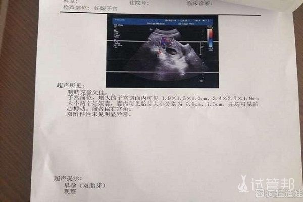 卵巢早衰还能做试管吗？哪些情况才能做试管？