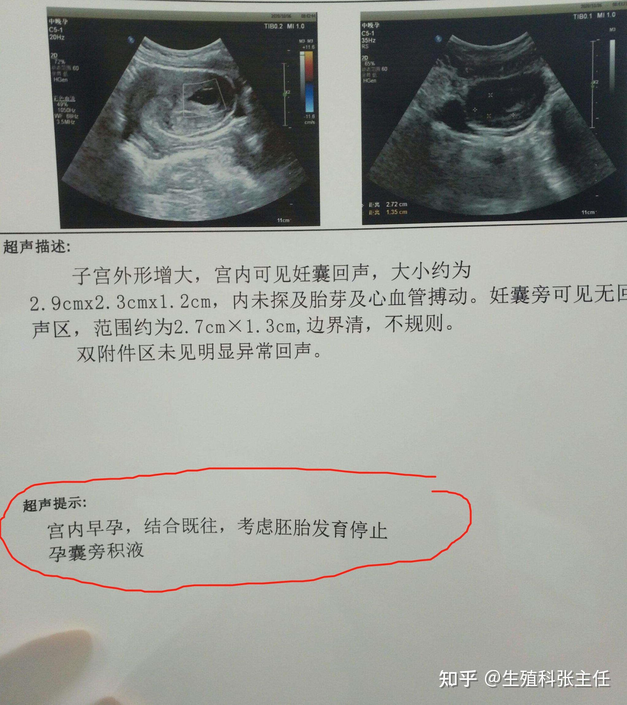 沈阳精子库不要学历,首批00后可以报名捐精啦