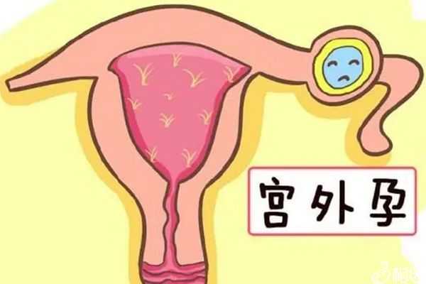 试管代怀一定会成功吗大约需要多久（需要多长时间能够完成？）