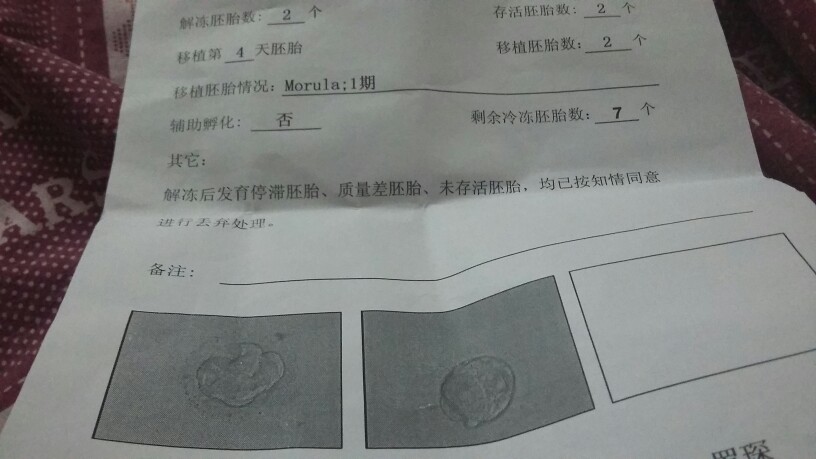 沈阳试管供卵选性别+沈阳供卵选性别