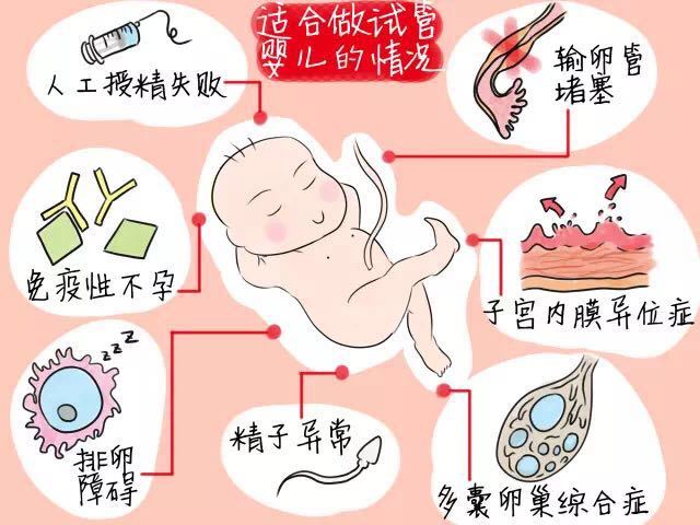 代生宝宝哪里便宜必须做腹腔镜吗