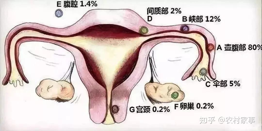 2024沈阳华西二院哪里有供卵代生公司费用明细表,三代费用5万元起